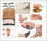 عوارض ناشی از دیابت